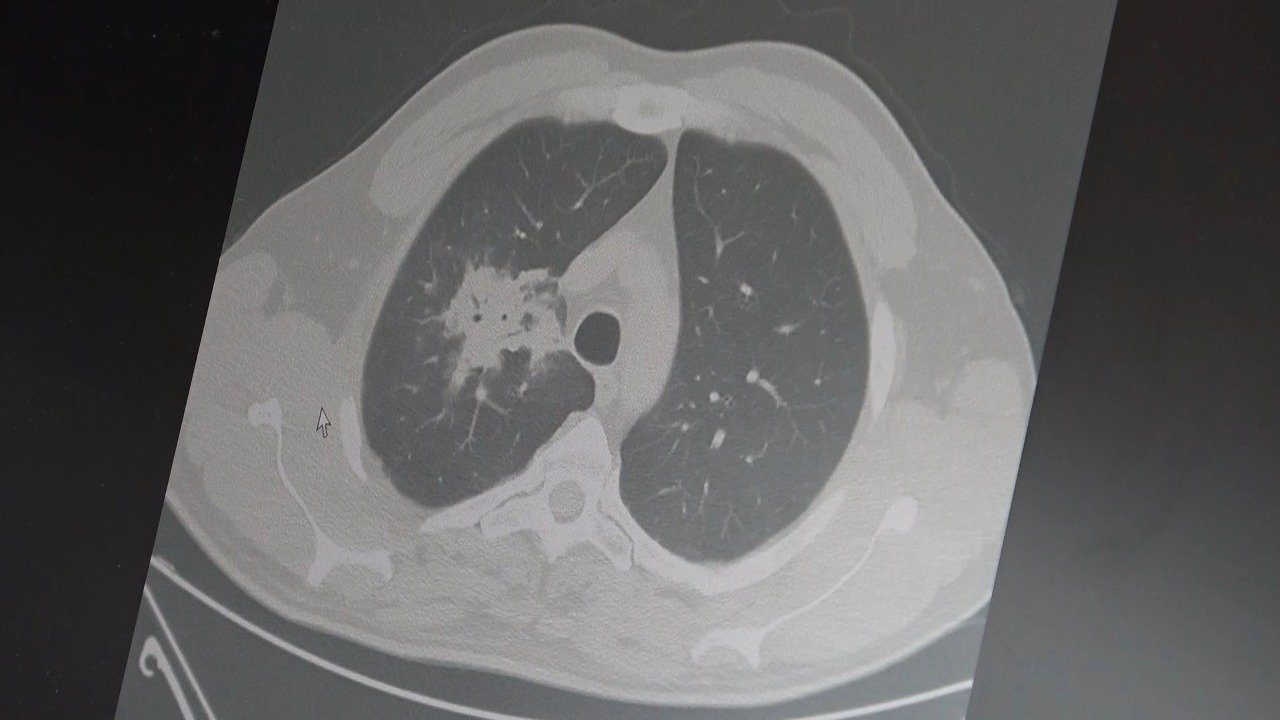 Elektronik sigara için “süre doldu”