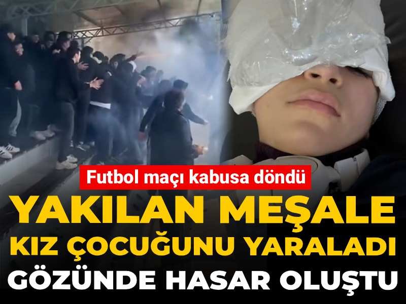 Futbol maçı kabusa döndü! Yakılan meşale kız çocuğunu yaraladı: Gözünde hasar oluştu
