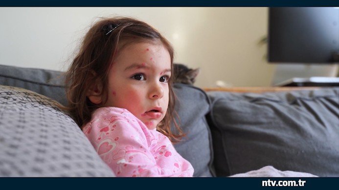 Unutulan hastalık geri mi dönüyor? İstanbul’da vaka sayılarında artış