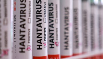 DSÖ Genel Direktörü yanıtladı. Hantavirüs küresel salgına dönüşür mü?